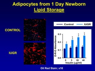 Adipocytes from 1 Day Newborn
Lipid Storage
CONTROL
IUGR
Oil Red Stain; x10
O-R-OAbsorbance
0.0
0.1
0.2
0.3
*
*
*
* *
*
c
c
c
c
Insulin (g/ml)
0 5 20 40
Control IUGR
 