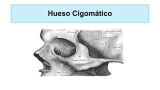 Hueso Cigomático
 