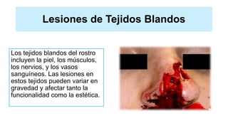 Lesiones de Tejidos Blandos
Los tejidos blandos del rostro
incluyen la piel, los músculos,
los nervios, y los vasos
sanguíneos. Las lesiones en
estos tejidos pueden variar en
gravedad y afectar tanto la
funcionalidad como la estética.
 