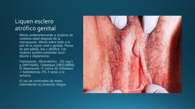 Rotacion dermatologia feb 2016 Rotacion dermatologia feb 2016