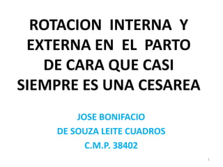 ROTACION INTERNA Y
EXTERNA EN EL PARTO
DE CARA QUE CASI
SIEMPRE ES UNA CESAREA
JOSE BONIFACIO
DE SOUZA LEITE CUADROS
C.M.P. 38402
1
 