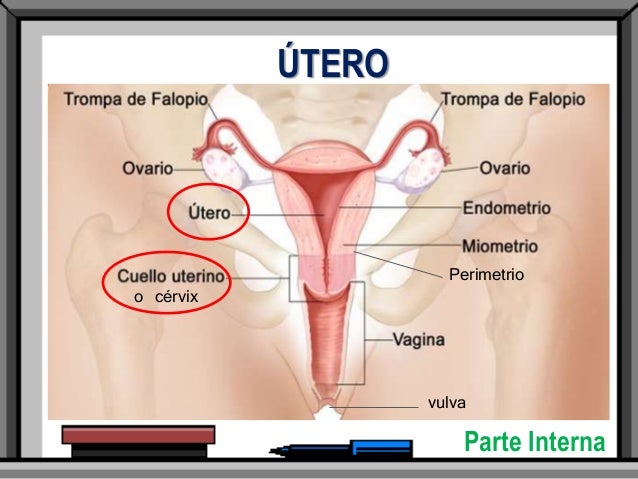 Resultado de imagen para Cáncer del cuerpo uterino