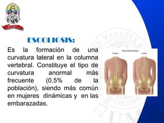 ESCOLIOSIS:
Es la formación de una
curvatura lateral en la columna
vertebral. Constituye el tipo de
curvatura anormal más
frecuente (0.5% de la
población), siendo más común
en mujeres dinámicas y en las
embarazadas.
 