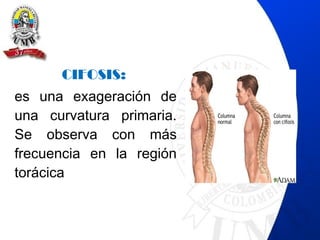 CIFOSIS:
es una exageración de
una curvatura primaria.
Se observa con más
frecuencia en la región
torácica
 