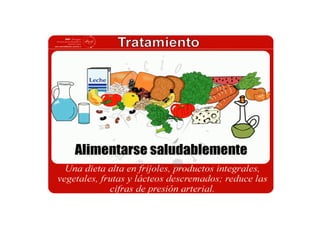 Rotafolio hipertension