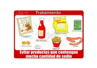 Rotafolio hipertension