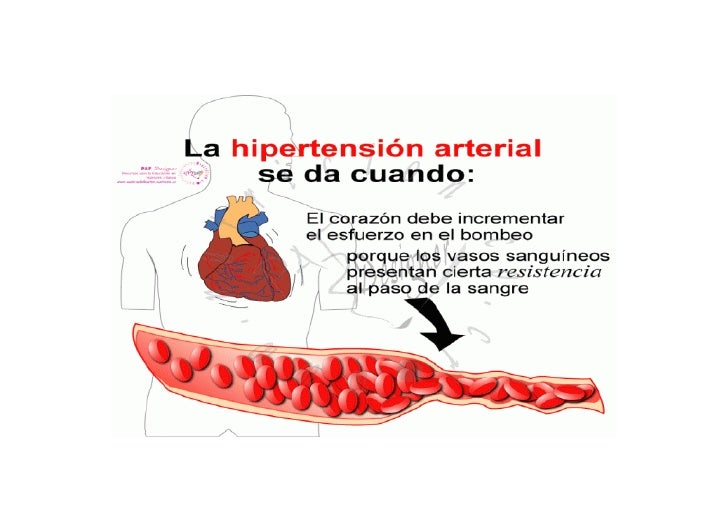 Rotafolio hipertension