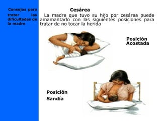 Consejos para
tratar las
dificultades de
la madre
Cesárea
La madre que tuvo su hijo por cesárea puede
amamantarlo con las siguientes posiciones para
tratar de no tocar la herida
Posición
Acostada
Posición
Sandía
 