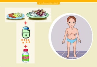 6. La Desnutrición Infantil




VITAMINA

  A
 