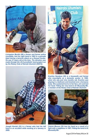 August 2016 ♦ Rotary Africa ♦ 35
Patrick Murura (35) lost his hand as a result of a
fight with a neighbour in 1997. Fitting the hand is Dr
Mussadiq Mir.
Joseph Kariuki (53) is a farmer who lost his left
hand in an accident while working at a tannery in
2009.
Everline Nandana (30) is a housewife and farmer
who moonlights as a domestic worker. In 1986,
when she was just nine months old, Everline was
playing in a bedroom and knocked over a kerosene
lamp. She sustained burns to her face, arm and lost
her hand. Fitting her new hand is Dr Mussadiq Mir,
a member of the Rotary Club of Nairobi Utumishi.
Livingston Murithi (66) a farmer and former police
constable, lost his right hand in 1992 in a grenade
blast during a terrorist attack on a Kenyan border.
He was 41 years old at the time. The donation was
made through the LN-4 prosthetic hand project run
by the Rotary Club of Nairobi Utumishi (D9212).
 
