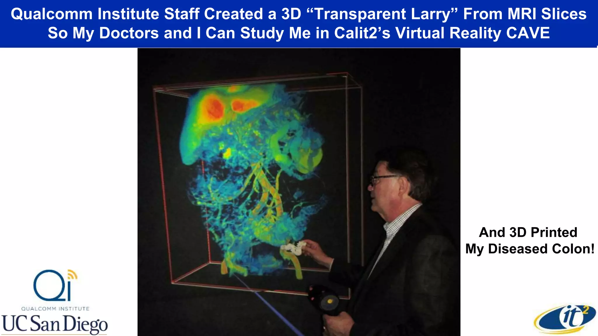 Qualcomm Institute Staff Created a 3D “Transparent Larry” From MRI Slices
So My Doctors and I Can Study Me in Calit2’s Virtual Reality CAVE
And 3D Printed
My Diseased Colon!
 
