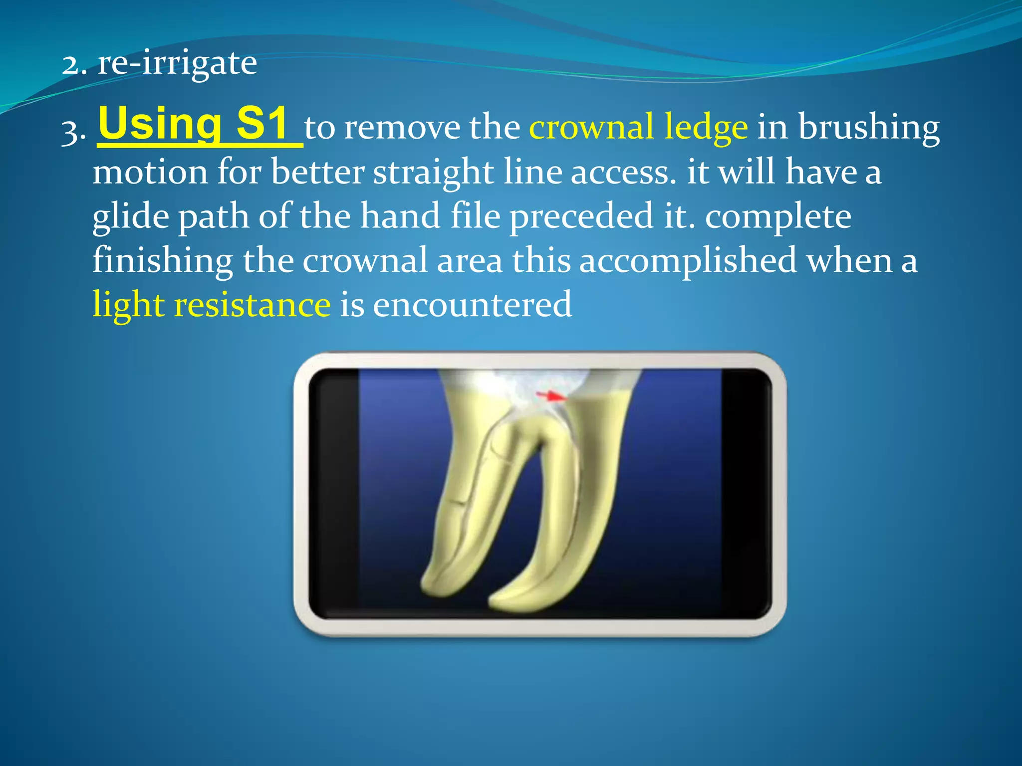 2. re-irrigate
3. Using S1 to remove the crownal ledge in brushing
motion for better straight line access. it will have a
glide path of the hand file preceded it. complete
finishing the crownal area this accomplished when a
light resistance is encountered
 