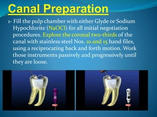 Canal Preparation
1- Fill the pulp chamber with either Glyde or Sodium
Hypochlorite (NaOCl) for all initial negotiation
procedures. Explore the coronal two-thirds of the
canal with stainless steel Nos. 10 and 15 hand files,
using a reciprocating back and forth motion. Work
those instruments passively and progressively until
they are loose.
 