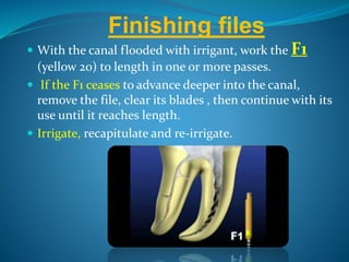 With the canal flooded with irrigant, work the F1
(yellow 20) to length in one or more passes.
 If the F1 ceases to advance deeper into the canal,
remove the file, clear its blades , then continue with its
use until it reaches length.
 Irrigate, recapitulate and re-irrigate.
Finishing files
 
