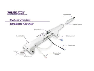 Step by Step Rotational Athrectomy | PPTX