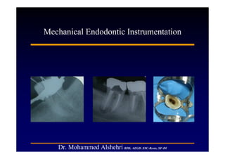 Mechanical Endodontic Instrumentation




   Dr. Mohammed Alshehri BDS, AEGD, SSC-Resto, SF-DI
 