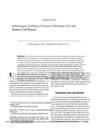 I Technical Note Arthroscopic Grafting of Greater Tuberosity Cyst and Rotator Cuff Repair Vivek Agrawal, M.D., and Matthew Stinson, P.A.-C. Abstract:  Cysts of the greater tuberosity can be a normal ﬁnding independent of age and concurrent rotator cuff tear. The presence of a large greater tuberosity cyst can present a challenge at the time of rotator cuff repair. We present a 1-step arthroscopic technique to address these defects at the time of rotator cuff repair using a synthetic graft (OsteoBiologics, San Antonio, TX) originally designed to  address  osteoarticular  defects.  With  the  viewing  portal  established  laterally,  a  portal  allowing perpendicular access to the cyst is established. The cyst is thoroughly debrided, and a drill sleeve is then introduced perpendicular to the surrounding bone, serving as a guide for the matching drill to create a circular socket. A correspondingly sized TruFit BGS cylindrical implant (OsteoBiologics) is then  implanted  by  use  of  the  included  instrumentation.  The  scaffold  is  placed  ﬂush  with  the surrounding bone. Because our arthroscopic rotator cuff protocol uses a tension-band technique with placement of suture anchors distal and lateral to the rotator cuff footprint, we are subsequently able to proceed with routine rotator cuff repair.  Key Words:  Rotator cuff repair  —Bone graft—Surgical technique—Humeral cyst. time of  rotator cuff repair . We present a 1-step arthro- scopic technique to address these defects at the time of rotator cuff repair using porous, resorbable scaffolds composed  of  polylactide– co-glycolide  copolymer, providing structure and calcium sulfate and promoting bone ingrowth (TruFit BGS Plug; OsteoBiologics, San Antonio, TX). TECHNIQUE AND CASE REPORT A 57-year-old woman slipped and fell onto her outstretched dominant arm, injuring her shoulder. Be- cause pain and weakness persisted despite conserva- tive management, she was referred to our shoulder clinic. A thorough radiographic and clinical examina- tion revealed the presence of both a rotator cuff tear and a signiﬁcant greater tuberosity subcortical cyst ( Fig 1 A). After a thorough review of the risks, bene- ﬁ ts, and options regarding treatment, along with our recommendations, the patient was eager to proceed with arthroscopic treatment. We routinely use a semi– lateral decubitus position for arthroscopic shoulder t is unclear whether cysts within the vicinity of the rotator cuff insertion on the greater tuberosity are  developmental,  are  correlated  with  age-related changes, or are speciﬁc to rotator cuff pathology. 1-4  A radiographic study of patients with symptomatic and surgically documented rotator cuff tears has shown a positive correlation with greater tuberosity cysts. 5  Ex- perimental work has also cited bone loss as a possible factor in poor healing of rotator cuff repairs. 6 The presence of cysts can present a dilemma at the From The Shoulder Center, St. Vincent Hospital, Indianapolis, Indiana, U.S.A. The authors report no conﬂict of interest. Zionsville,  IN  46077,  U.S.A.  E-mail:  [email_address] Center.com © 2007 by the Arthroscopy Association of North America C of  greater  tuberosity  cyst  and  rotator  cuff  repair.  Ary 2007;23:904.e1-904.e3 [doi:10.1016/j.arthro.2006.10.026]. 0749-8063/07/2308-6387$32.00/0 doi:10.1016/j.arthro.2006.10.026 904.e1 Arthroscopy: The Journal of Arthroscopic and Related Surgery, Vol 23, No 8 (August), 2007: pp 904.e1-904.e3 
