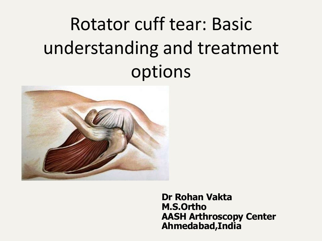 Rotator cuff Tear and its management