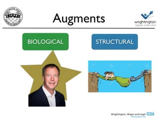 Augments
BIOLOGICAL STRUCTURAL
 