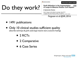 Ferguson et al.AJSM, 2016
Do they work?
• 1491 publications
 

• Only 10 clinical studies suf
fi
cient quality
 
(describe technique & graft used; large-massive tears; outcome healing)
• 2 RCT
s

• 2 Comparativ
e

• 6 Case Series
 
 