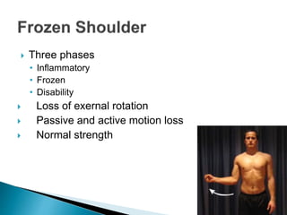  Three phases
• Inflammatory
• Frozen
• Disability
 Loss of exernal rotation
 Passive and active motion loss
 Normal strength
 