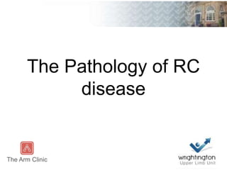 The Pathology of RC
disease
 