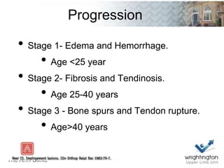 Progression
• Stage 1- Edema and Hemorrhage.
• Age <25 year
• Stage 2- Fibrosis and Tendinosis.
• Age 25-40 years
• Stage 3 - Bone spurs and Tendon rupture.
• Age>40 years
 