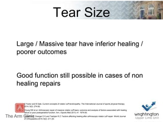 Tear Size
Large / Massive tear have inferior healing /
poorer outcomes
Good function still possible in cases of non
healing repairs
D Factor and B Dale. Current concepts of rotator cuff tendinopathy. The International Journal of sports physical therapy
2014; 9(2): 274-82.
Chung SW et al. Arthroscopic repair of massive rotator cuff tears: outcome and analysis of factors associated with healing
failure or poor postoperative function. Am J Sports Med 2013; 41: 1674-83.
Abtahi A M, Granger E K and Tashjian R Z. Factors affecting healing after arthroscopic rotator cuff repair. World Journal
of Orthopaedics 2015; 6(2): 211-20.
 