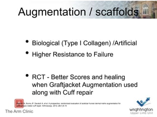 Augmentation / scaffolds
• Biological (Type I Collagen) /Artificial
• Higher Resistance to Failure
• RCT - Better Scores and healing
when Graftjacket Augmentation used
along with Cuff repair
Barber FA, Burns JP, Deutsch A, et al. A prospective, randomized evaluation of acellular human dermal matrix augmentation for
arthroscopic rotator cuff repair. Arthroscopy. 2012; 28(1):8-15
 