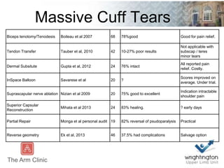 Massive Cuff Tears
Biceps tenotomy/Tenodesis Boileau et al 2007 68 78%good Good for pain relief.
Tendon Transfer Tauber et al, 2010 42 10-27% poor results
Not applicable with
subscap / teres
minor tears
Dermal Subsitute Gupta et al, 2012 24 76% intact
All reported pain
relief. Costly.
InSpace Balloon Savarese et al 20 ?
Scores improved on
average. Under trial.
Suprascapular nerve ablation Nizian et al 2009 20 75% good to excellent
Indication intractable
shoulder pain
Superior Capsular
Reconstruction
Mihata et al 2013 24 83% healing. ? early days
Partial Repair Monga et al personal audit 19 82% reversal of psudoparalysis Practical
Reverse geometry Ek et al, 2013 46 37.5% had complications Salvage option
 