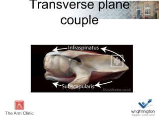 Transverse plane
couple
 