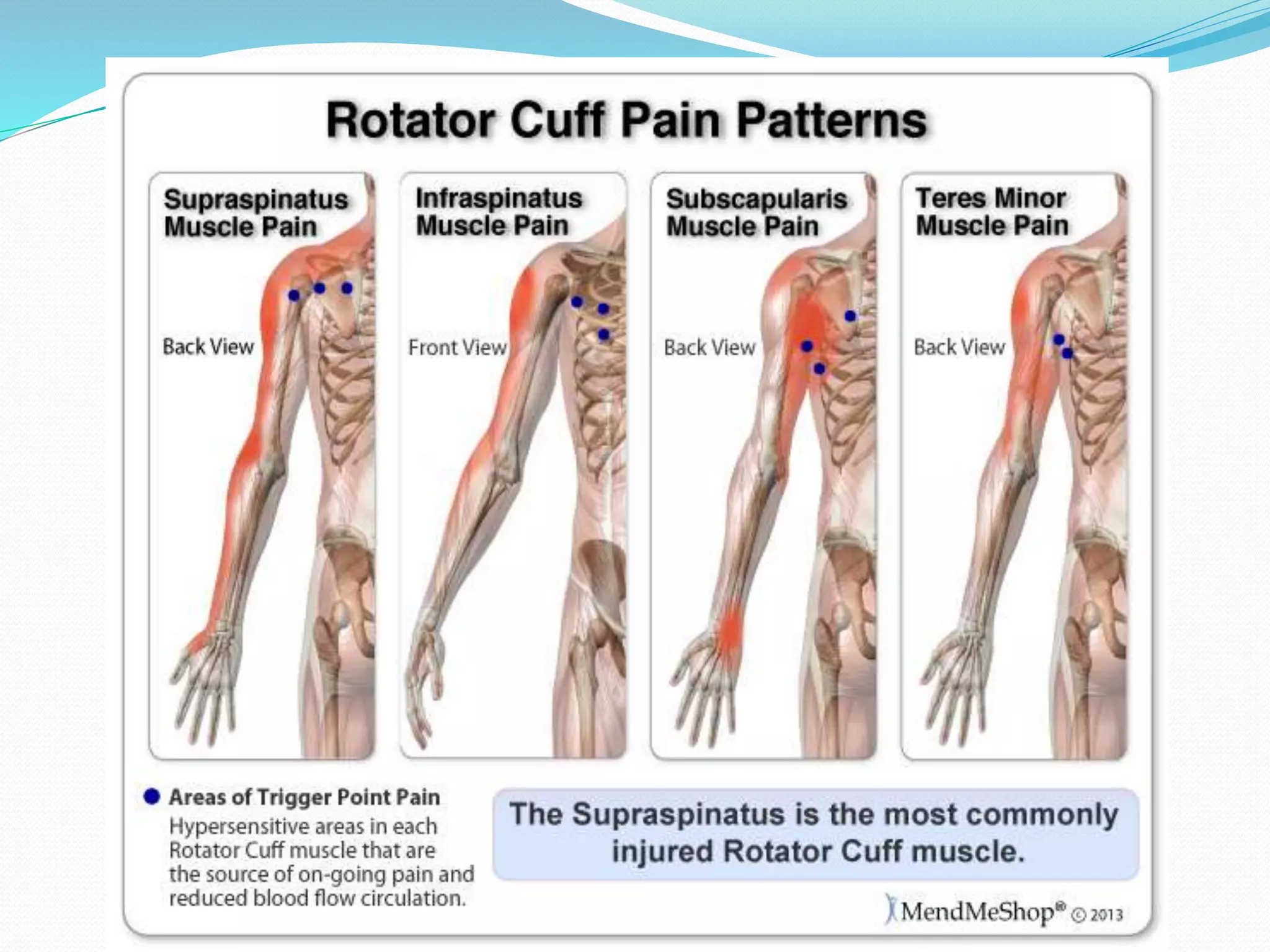 Rotator cuff injuries | PPTX