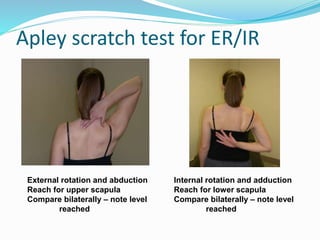 Apley scratch test for ER/IR
Internal rotation and adduction
Reach for lower scapula
Compare bilaterally – note level
reached
External rotation and abduction
Reach for upper scapula
Compare bilaterally – note level
reached
 