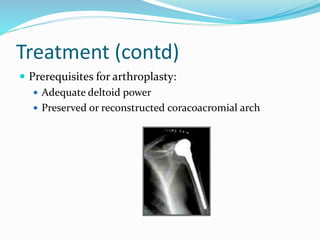 Treatment (contd)
 Prerequisites for arthroplasty:
 Adequate deltoid power
 Preserved or reconstructed coracoacromial arch
 