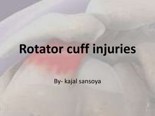Rotator cuff injuries
By- kajal sansoya
 