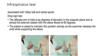 Rotator Cuff Injuries present at Chirayu Medical College.pptx