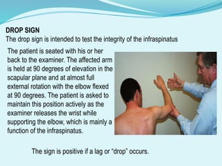 ROTATOR_CUFF_INJURIES classification, management (1).pptx