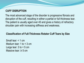 ROTATOR_CUFF_INJURIES classification, management (1).pptx
