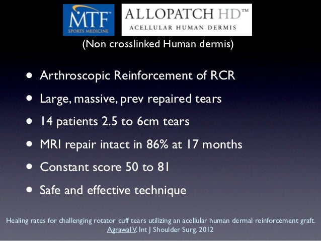 Transdermal patches available in market image