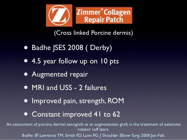 List of fda-approved transdermal patches picture