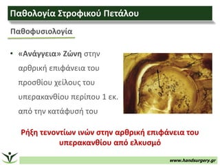 www.handsurgery.gr
Παθοφυσιολογία
• «Ανάγγεια» Ζώνη στην
αρθρική επιφάνεια του
προσθίου χείλους του
υπερακανθίου περίπου 1...