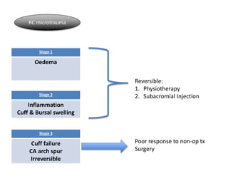 Stage 1
Oedema
Stage 2
Inflammation
Cuff & Bursal swelling
Stage 3
Cuff failure
CA arch spur
Irreversible
RC microtrauma
Reversible:
1. Physiotherapy
2. Subacromial Injection
Poor response to non-op tx
Surgery
 