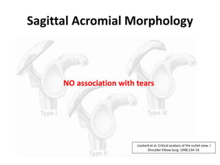 Sagittal Acromial Morphology
NO association with tears
Lisotard et al. Critical analysis of the outlet view. J
Shoulder Elbow Surg. 1998;134-19.
 