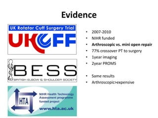 Evidence
• 2007-2010
• NIHR funded
• Arthroscopic vs. mini open repair
• 77% crossover PT to surgery
• 1year imaging
• 2year PROMS
• Same results
• Arthroscopic>expensive
 