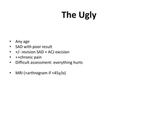 The Ugly
• 2o impingement already operated on elsewhere
• Any age
• SAD with poor result
• +/- revision SAD + ACJ excision
• ++chronic pain
• Difficult assessment: everything hurts
• MRI (+arthrogram if <45y/o)
• No labral tear: pain management + scapular rehab + manage
expectations
• Labral tear: diagnostic glenoumeral injection +/- labral repair
 