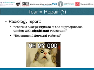 Tear = Repair (?)
• Radiology report:

• “There is a large rupture of the supraspinatus
tendon with significant retraction”
• “Recommend Surgical referral”
 