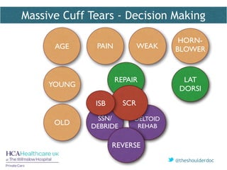 @theshoulderdoc
REPAIR
YOUNG
OLD
LAT
DORSI
SSN/
DEBRIDE
DELTOID
REHAB
REVERSE
SCRISB
PAIN WEAK
HORN-
BLOWERAGE
Massive Cuff Tears - Decision Making
 