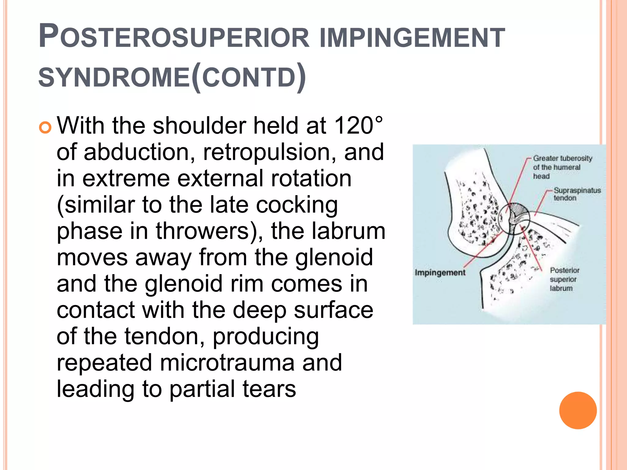 POSTEROSUPERIOR IMPINGEMENT
SYNDROME(CONTD)
 With the shoulder held at 120°
of abduction, retropulsion, and
in extreme external rotation
(similar to the late cocking
phase in throwers), the labrum
moves away from the glenoid
and the glenoid rim comes in
contact with the deep surface
of the tendon, producing
repeated microtrauma and
leading to partial tears
 