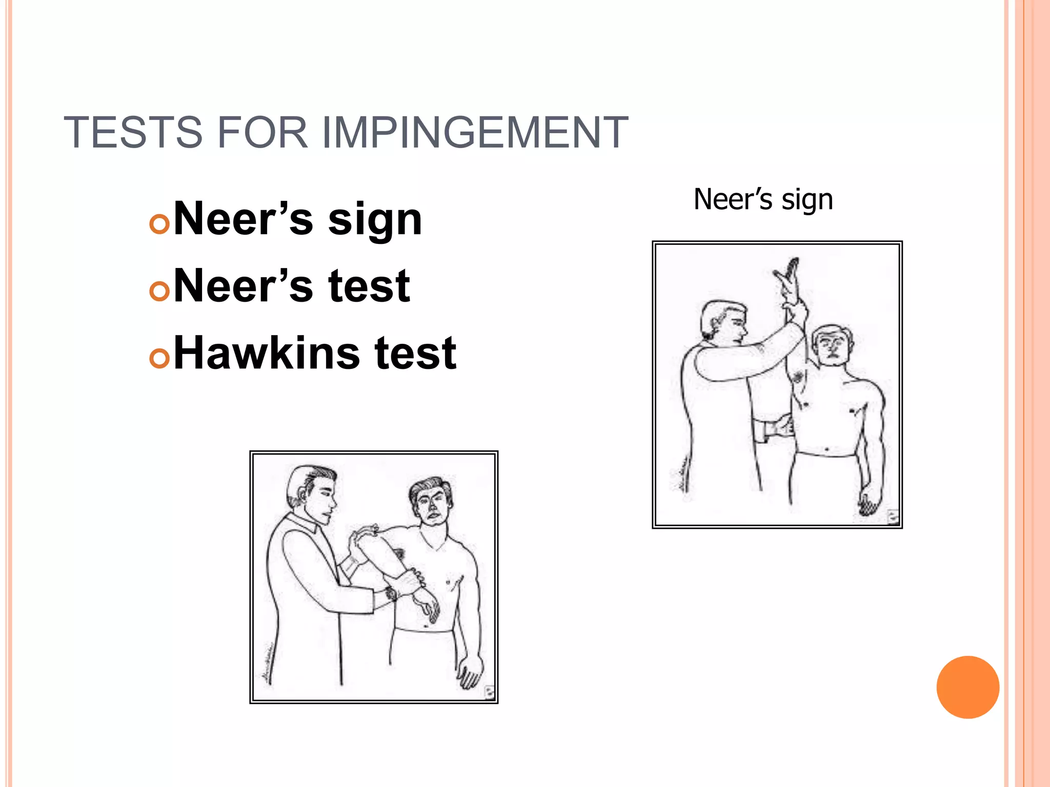 TESTS FOR IMPINGEMENT
Neer’s sign
Neer’s test
Hawkins test
Neer’s sign
 