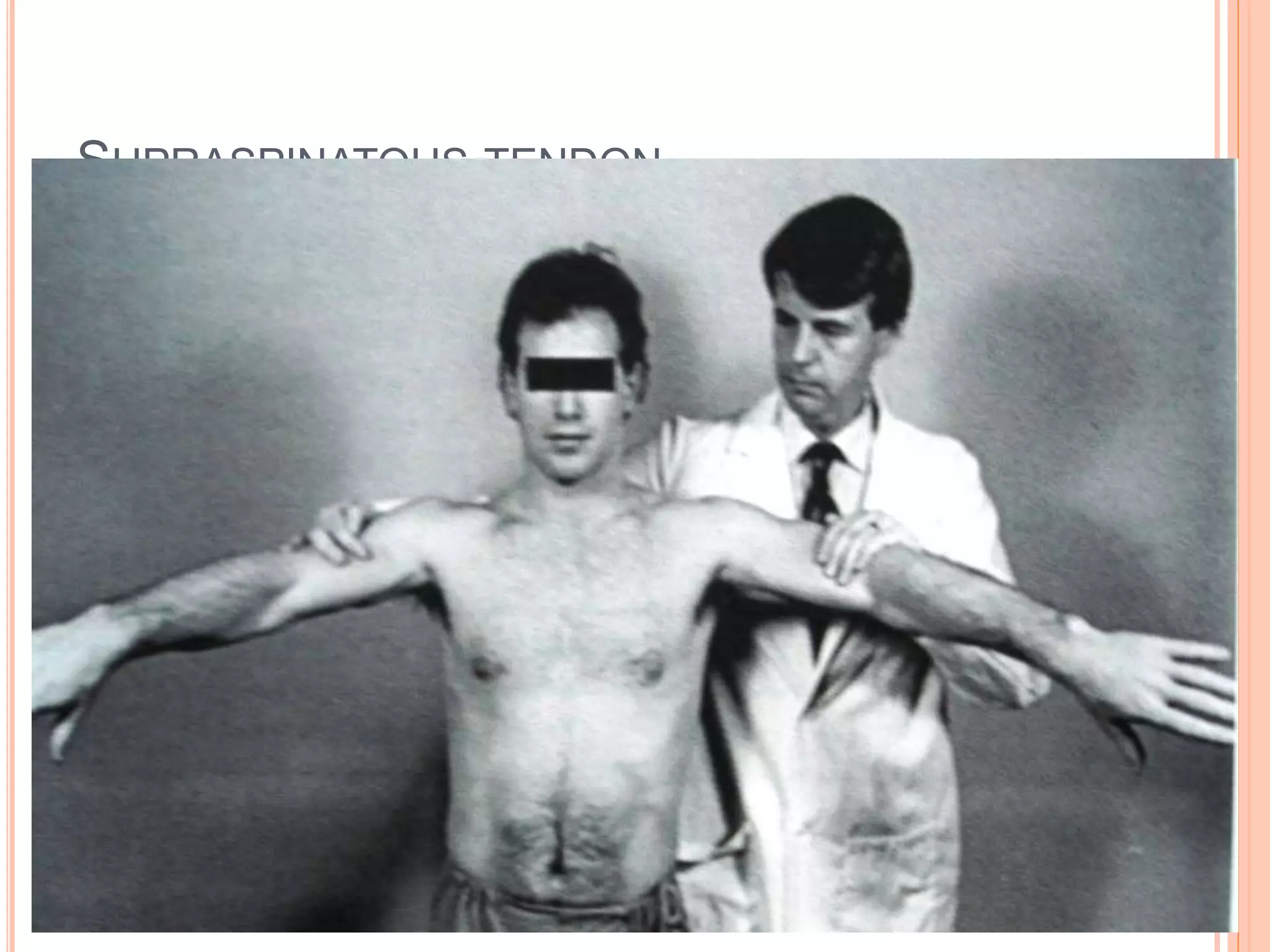 SUPRASPINATOUS TENDON
 